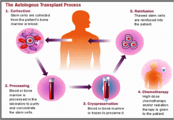 The steps involved in stem cell processing